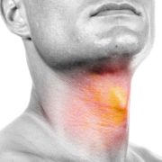 Experts-in-Head-and-Neck-Cancer Experts-in-Head-and-Neck-Cancer