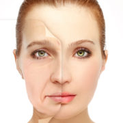 Facelift-web Facelift-web